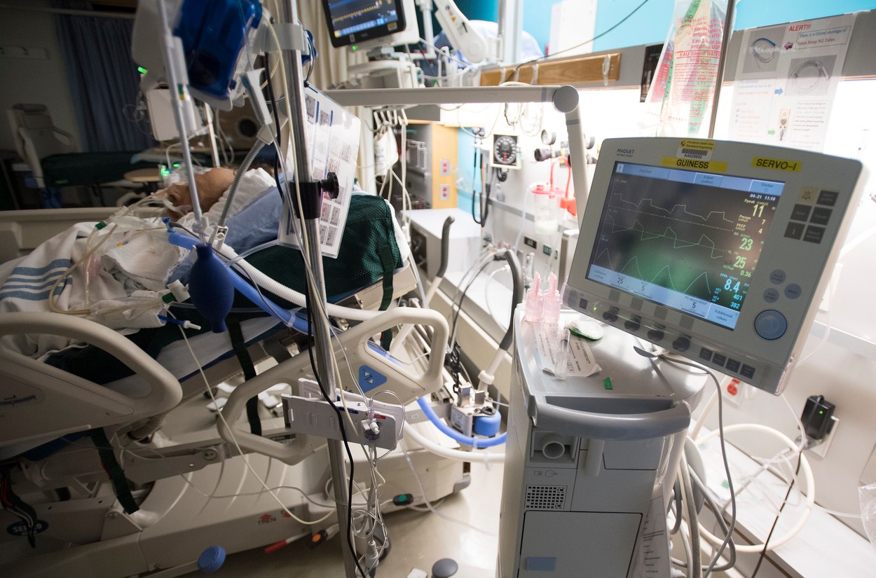 April 21, 2020, Vancouver, BC, Canada: A patient is attached to a ventilator in the COVID-19 intensive care unit at St. Paul's hospital in downtown Vancouver, Tuesday, April 21, 2020., Image: 514611965, License: Rights-managed, Restrictions: * Canada and U.S. RIGHTS OUT *, Model Release: no, Credit line: Jonathan Hayward / Zuma Press / Profimedia