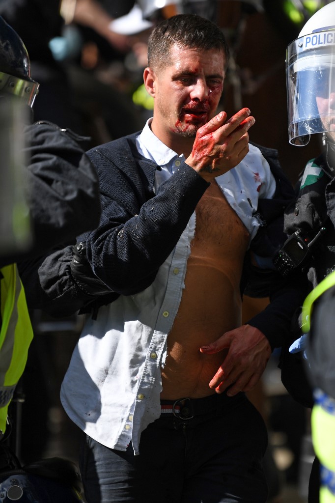 An injured man is taken away by police after fights take place in Trafalgar Square as protesters supporting the Black Lives Matter movement clash with opponents in central London on June 13, 2020, in the aftermath of the death of unarmed black man George Floyd in police custody in the US. - Police in London have urged people planning to attend anti-racism and counter protests on Saturday not to turn out, citing government regulations banning gatherings during the coronavirus pandemic. (Photo by DANIEL LEAL-OLIVAS / AFP)