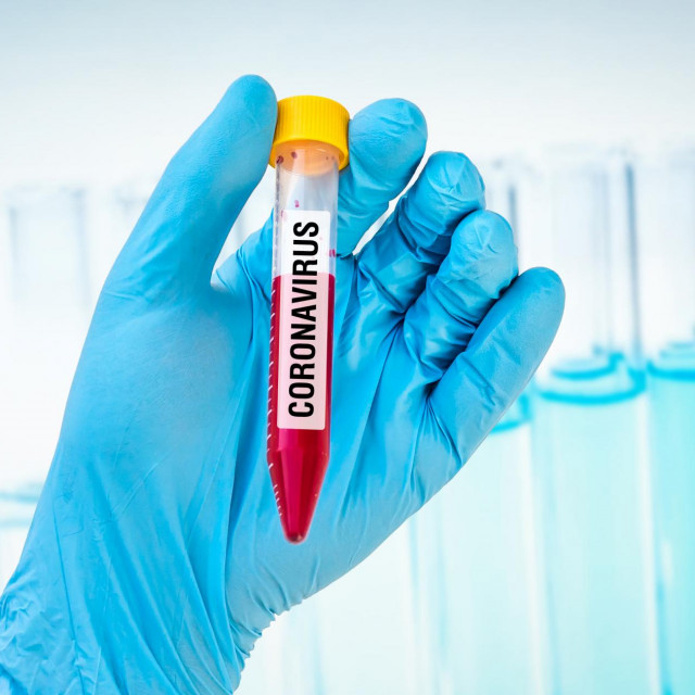 Hand of scientist is holding a test-tube with positive blood test on CORONAVIRUS