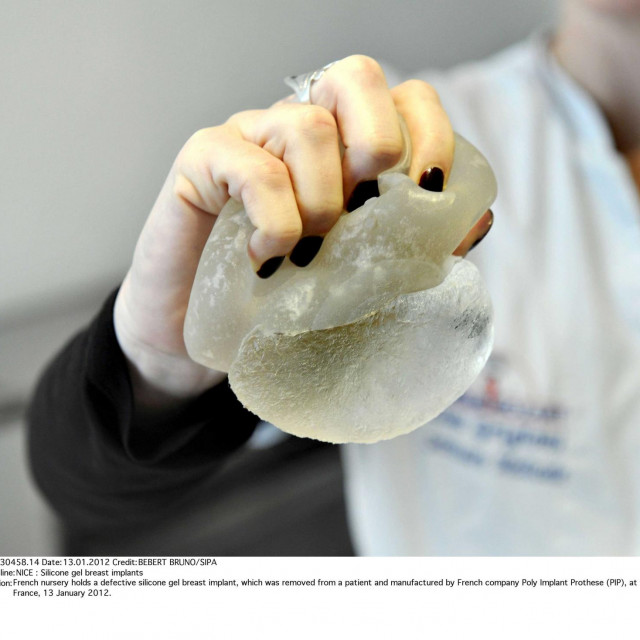 Medicinska sestra u Francuskoj drži neispravan implantat kojeg su uklonili pacijentici u klinici u Nici
