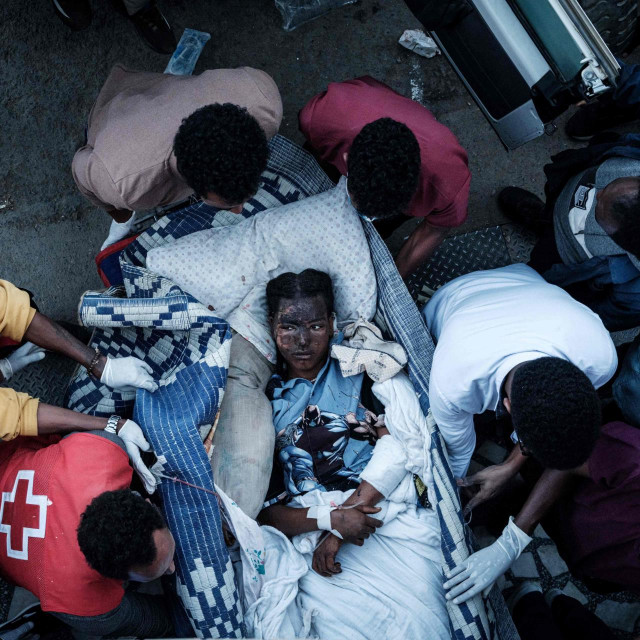 Ozljeđena stanovnica Togoge na putu prema bolnici u Mekeleu