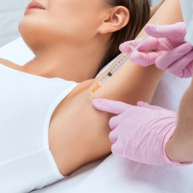 &lt;p&gt;The doctor makes injections of botulinum toxin in the underarm area against hyperhidrosis. Women&amp;#39;s cosmetology concept.&lt;/p&gt;
