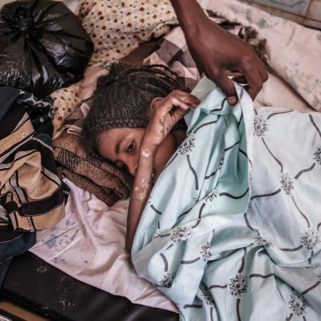&lt;p&gt;Assia Abdu (8), žrtva sukoba u Etiopiji&lt;/p&gt;
