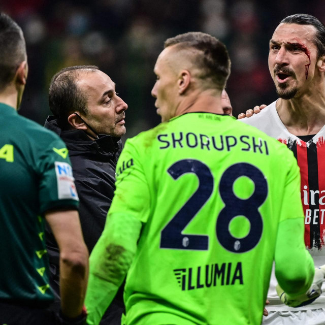 &lt;p&gt;AC Milan&amp;#39;s Swedish forward Zlatan Ibrahimovic reacts after being injured following a collision during the Italian Serie A football match between AC Milan and Bologna on April 4, 2022 at the San Siro stadium in Milan. (Photo by MIGUEL MEDINA/AFP)&lt;/p&gt;