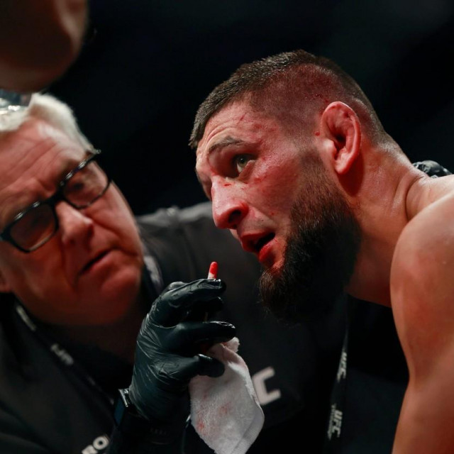 &lt;p&gt;Khamzat Chimaev looks on from his corner during a welterweight bout against Gilbert Burns Saturday, April 9, 2022 during UFC 273 at VyStar Veterans Memorial Arena in Jacksonville. Chimaev won by unanimous decision. [Corey Perrine/Florida Times-Union]&lt;br /&gt;
&lt;br /&gt;
Jki 041022 Ufc273 38,Image: 682339571, License: Rights-managed, Restrictions: *** World Rights ***, Model Release: no, Credit line: USA TODAY Network/ddp USA/Profimedia&lt;/p&gt;