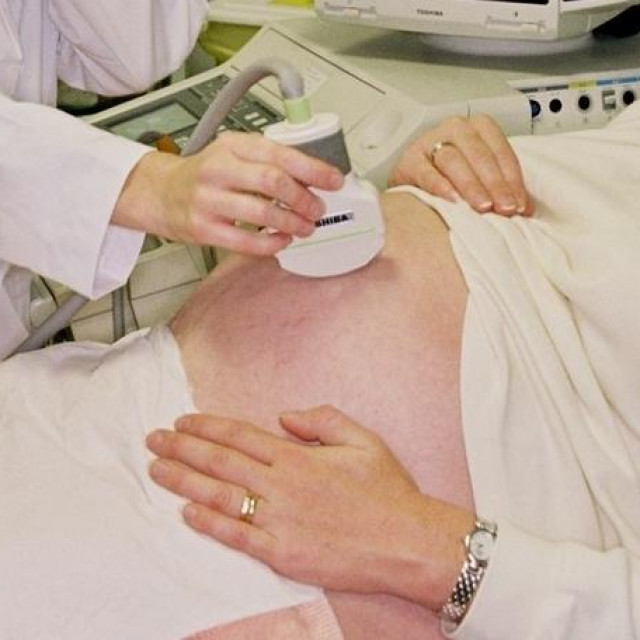 &lt;p&gt;Ultrazvučni pregled trudnice/Ilustracija&lt;/p&gt;