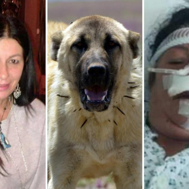 &lt;p&gt;Gordana Martinec prije napada psa i u splitskoj bolnici nakon operacije; Kangalski ovčar/Ilustracija&lt;/p&gt;