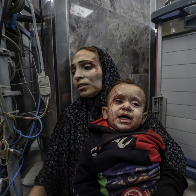 &lt;p&gt;Napad na bolnicu u Gazi&lt;/p&gt;