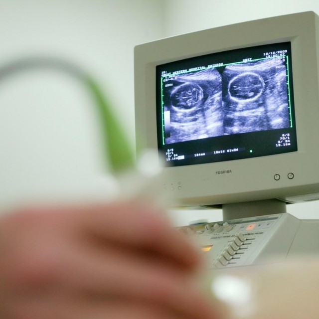 Ilustracija, ultrazvuk tijekom trudnoće