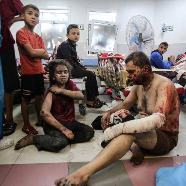 &lt;p&gt;Ranjeni u bolnici u Gazi&lt;/p&gt;