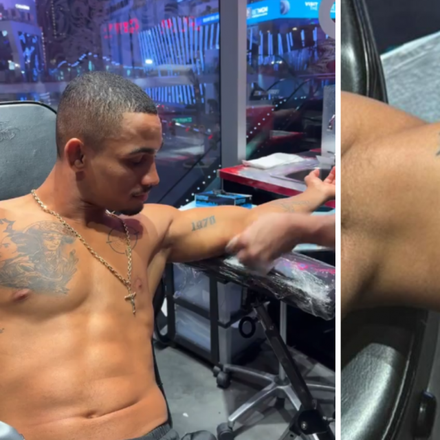 Andre Lima s tetovažom nakon ugriza