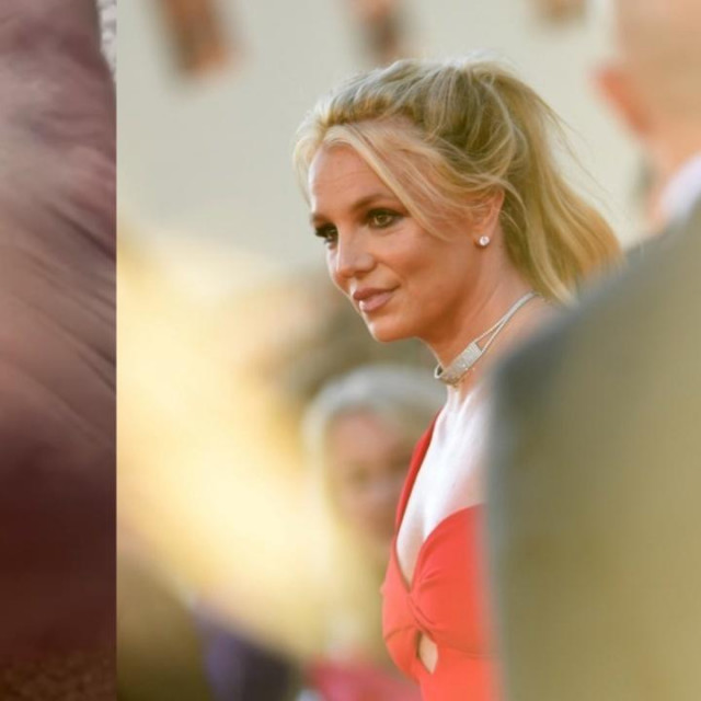 Britney Spears pokazala je svoj ranjeni gležanj