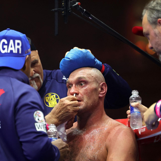 Britain‘s Tyson Fury (C) receives medical attention from his team during a heavyweight boxing world championship fight against Ukraine‘s Oleksandr Usyk at Kingdom Arena in Riyadh, Saudi Arabia on May 19, 2024. Oleksandr Usyk beat Tyson Fury by split decision to win the world‘s first undisputed heavyweight championship in 25 years on May 19, 2024, an unprecedented feat in boxing‘s four-belt era. (Photo by Fayez NURELDINE/AFP)