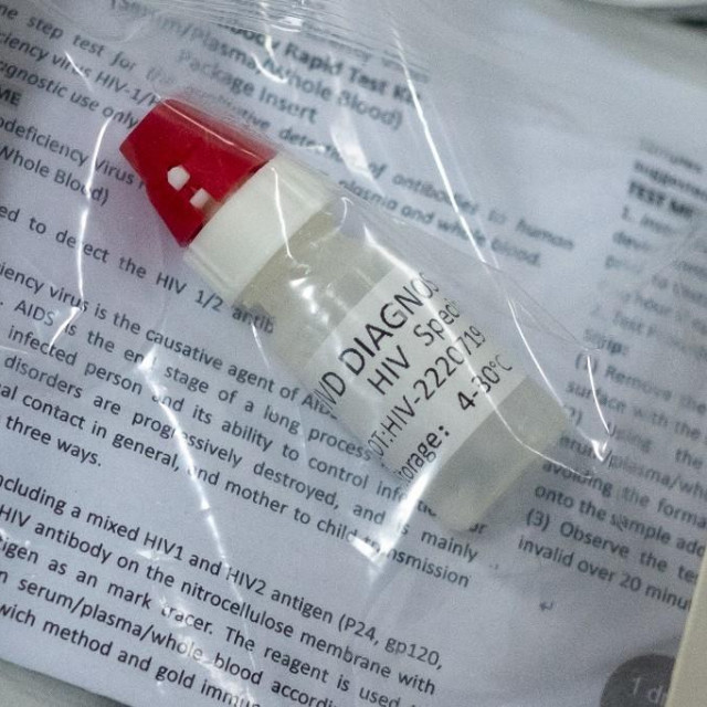 Test za HIV