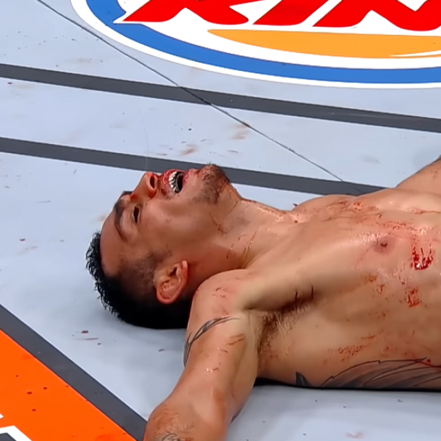 Tony Ferguson