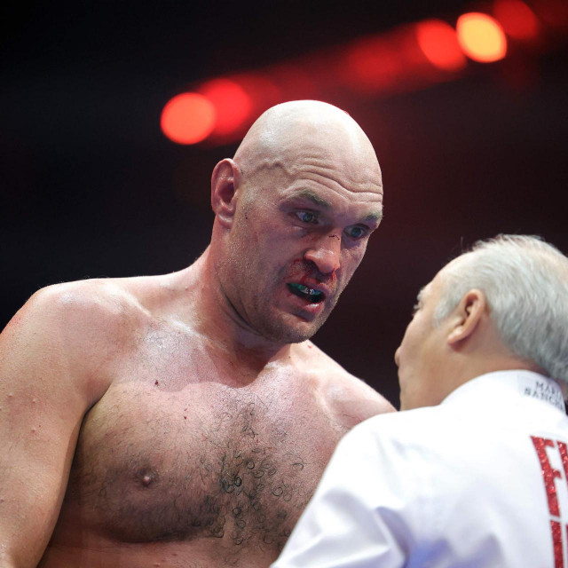 Tyson Fury 