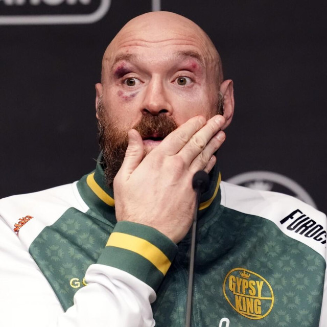 Tyson Fury