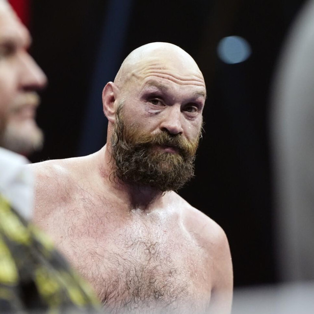 Tyson Fury