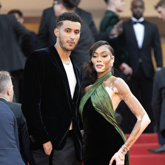 Kyle Kuzma i Winnie Harlow zajedno su pet godina