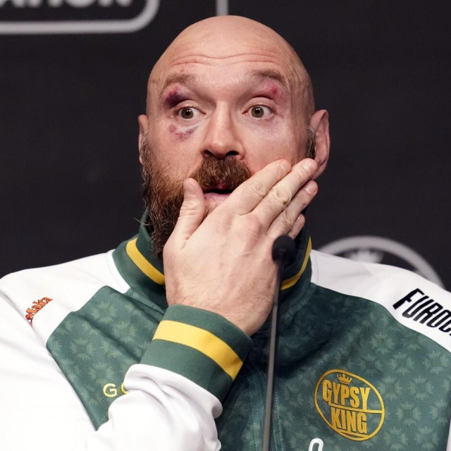 Tyson Fury 