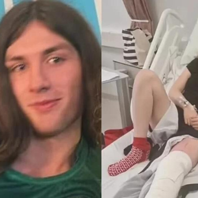 Transrodna ragbijašica poslala protivnicu na operaciju